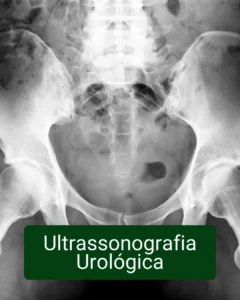 Dr Fernando Frederico Próstata - Urofill - HoLep - Engrossamento Peniano - Prótese Peniana - Cirurgia minimamente Invasiva - cirurgia Robótica - cirurgia de próstata - Umuarama PR paraná